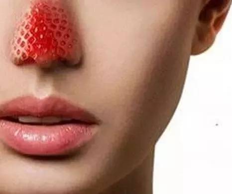 草莓鼻泛红修复要多久